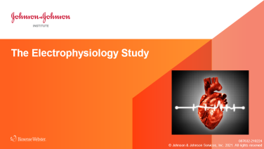 An image from the "The Electrophysiology Study" on JnJInstitute.com website