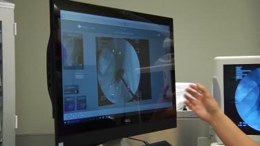 An image of the "JointPoint™ Hip Navigation System Operating Room Workflow for Anterior Approach Total Hip Arthroplasty with Andrew Cooper, MD" video.