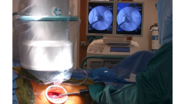 An image of the "History of the Anterior Approach in Total Hip Arthroplasty with Joel Matta, MD" video on the JnJInstitute.com website.
