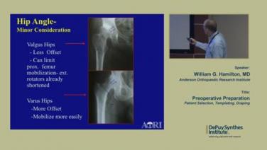 An image of the "Preoperative Preparation for an Anterior Approach Surgery with William Hamilton, MD" video.