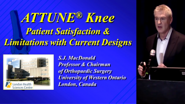An image from the "The ATTUNE® Knee System: Adoption of a New Knee System & the Quest for Patient Satisfaction" video on the JnJInstitute.com website.