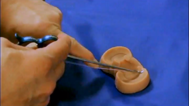 An image from the "TRUESPAN™ Meniscal Repair System with David Diduch, MD" video on the JnJInstitute.com website.