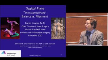 An image of the "Sagittal Plane - Balance vs. Alignment with Baron Lonner, MD" video.