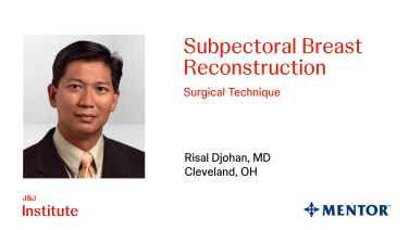 An Image from "Subprectoral Breast Reconstruction with Dr. Risal Djohan"