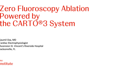 An Image From "Zero Fluoroscopy Ablation Powered by the CARTO®3 System"