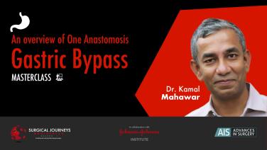 An Image From "An Overview of One Anastomosis Gastric Bypass"