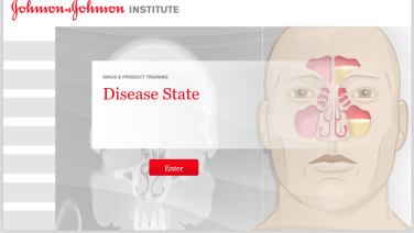 An image from the "Diseases of the Paranasal Sinuses" on JnJInstitute.com website