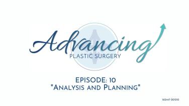 Episode 10: Analysis & Planning Header Image