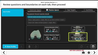 VELYS™Robotic- Assisted Solution with Autoplan Software Review and Clinical Benefits of the Technology for the Functional Alignment Approach with Daniel Huang, DO