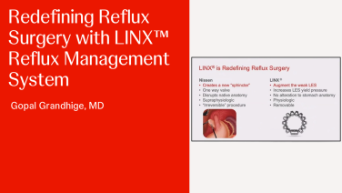 An Image From "Redefining Reflux Surgery with Gopal Grandhige, MD"