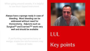 An Image From "Technical Tips and Surgical Strategies for Performing Left Upper Lobectomies with Zane Hammoud, MD"