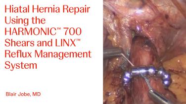 Step-by-Step Demonstration of a Hiatal Hernia Repair with Blair Jobe, MD
