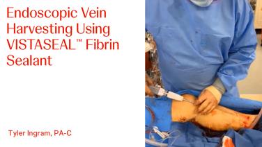 An image From "Endoscopic Vein Harvesting Using VISTASEAL™ Fibrin Sealant with Tyler Ingram, PA-C"