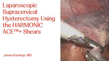 An image of the "Laparoscopic Supracervical Hysterectomy using HARMONIC ACE+ with James Kondrup, MD" video on the JnJInstitute.com website.