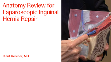An Image from "Anatomy Review for Laparoscopic Inguinal Hernia Repair with Kent Kercher, MD"