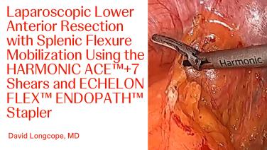 Laparoscopic Lower Anterior Resection with Splenic Flexure Mobilization 