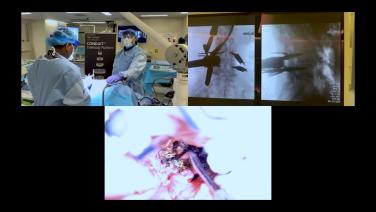 MIS TLIF Procedural Workflow with Kamal Woods, MD thumbnail image