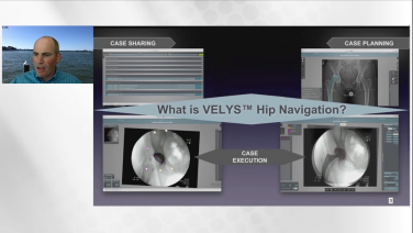 Image from VELYS Hip Navigation Technology Overview - Andrew Cooper, MD