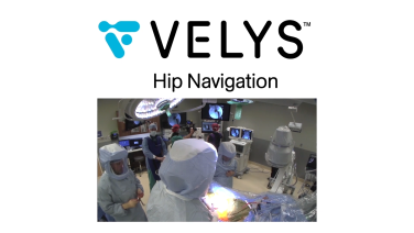 Image from VELYS Hip Navigation Workflow - Andrew Cooper