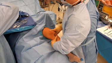 image from ACL Reconstruction Surgical Technique with Anthony Scillia, MD