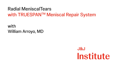 image from Radial MeniscalTears with TRUESPAN Meniscal Repair System with William Arroyo, MD 