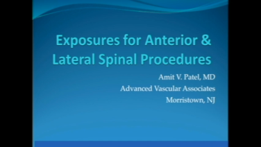 Image from Exposures in ALIF and Lateral Spine Procedures - Amit Patel, MD