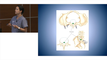 Image from Lumbopelvic Fixation & Iliac Crest Bone Grafting with Lauren Matteini, MD