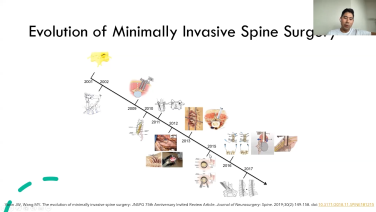 An Image From "OR Setup & Navigation: Best Practices for Lateral Fusion - Jang Yoon MD"