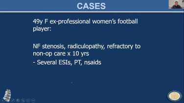 An Image From "MIS Approach - TLIF Case Study - Todd Allen MD PhD"