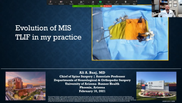 An Image From "MIS TLIF Personal Journey & Benefits - Ali Baaj MD "