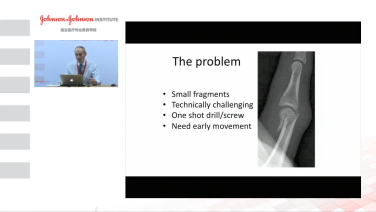 Image from Phalangeal Base Plate Surgical Technique Pearls - Douglas Campbell, MD
