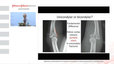 An Image From "Proximal Interphalangeal Joint Disclocations - Douglas Campbell, MD"