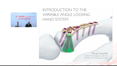 Image from Variable Angle Hand Locking System Review and Surgical Technique Demonstration - Douglas Campbell, MD