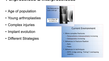 An Image From "Expanding Fixation Options for Periprosthetic Fractures - Frank Liporace, MD"