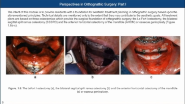 Slide with images of a open mouth highlighting the teeth from Perspectives in Orthognathic Surgery Part I with Harvey Rosen, DMD