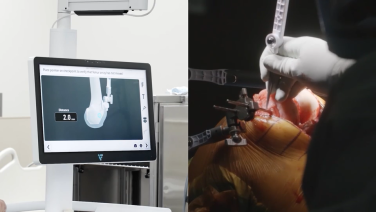 Alternative Alignment using VELYS™ Robotic Assisted System: An Experienced User Alternative Alignment with Sayfe Jassim, MD