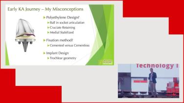 Technology Integration: My Journey from Manual to Robotic TKA - Kinematic Alignment with Bryan Haughom, MD thumbnail