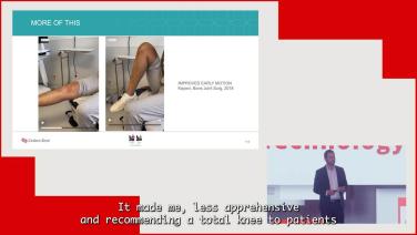 Technology Integration: My Journey from Manual to Robotic TKA - Inverse Kinematic Alignment with Sean Rajaee, MD thumbnail