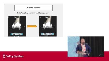 Slide with HCP from VELYS™ Robotic-Assisted Solution: Built for Kinematics with John Redmond, MD