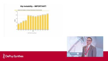 Slide from Accounting for the Spine in total hip arthroplasty with Timothy Alton, MD