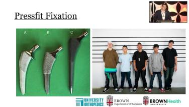 power point slide from Femoral Stem Fixation with Thomas Barrett, MD