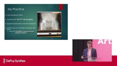 Slide from Accounting for spine in total hip arthroplasty; Overcomplicating a procedure that already works! with Colin Mudrick, MD