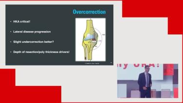 Literature Review of Unicompartmental with Robotics with Timothy Alton, MD thumbnail