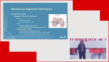 Mechanical Knee Alignment Techniques with Meghan Manthe, MD thumbnail