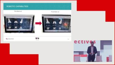 Fundamentals of Inverse Kinematic Alignment and Clinical Outcomes with Sean Rajaee, MD thumbnail
