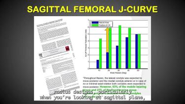 Knee Implants: Design Intent, Not all Designs are Created Equal with Douglas Dennis, MD thumbnail