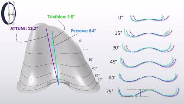 Knee Implant Design Features for Kinematic Restoration with Chadd Clary, PhD thumbnail