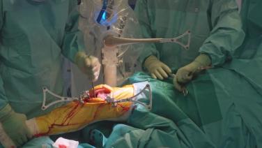 doctors holding a knee during the procedure within SIGMA™ Medial Partial Knee Procedure with VELYS™ Robotic-Assisted Solution