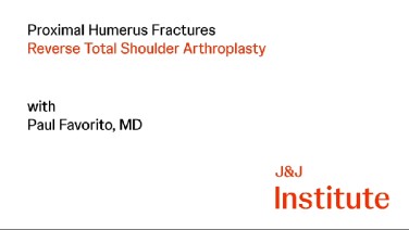 Reverse Total Shoulder Arthroplasty for Proximal Humerus Fracture with Paul Favorito, MD thumbnail