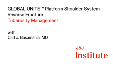GLOBAL UNITE Platform System- Reverse Fracture with Carl Basamania, MD thumbnail